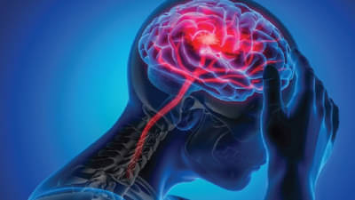 उच्च रक्तदाब आणि मधुमेह असलेल्या कोविड रुग्णांना ब्रेन स्ट्रोकचा धोका अधिक; इंग्लंडच्या संशोधकांचा दावा