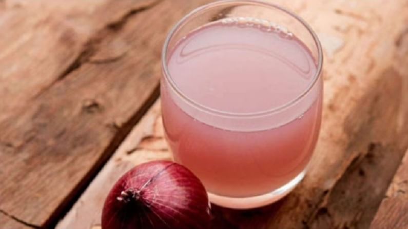 Onion Juice : डोक्यातील कोंड्यापासून मुक्ती मिळवण्यासाठी अशा प्रकारे वापरा कांद्याचा रस