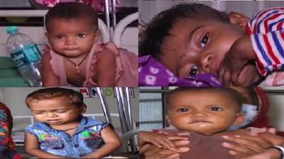 कुपोषित बालके शोधण्यासाठी स्पेशल ड्राईव्ह, नंदूरबार पॅटर्न आता राज्यात राबविला जाणार