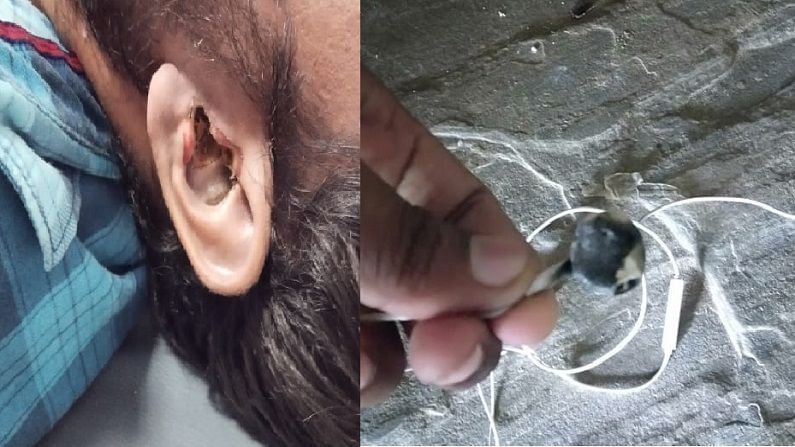 Earphones Blast : गाणी ऐकताना ईअरफोन कानातच फुटले, तरुणाचा जागेवर मृत्यू