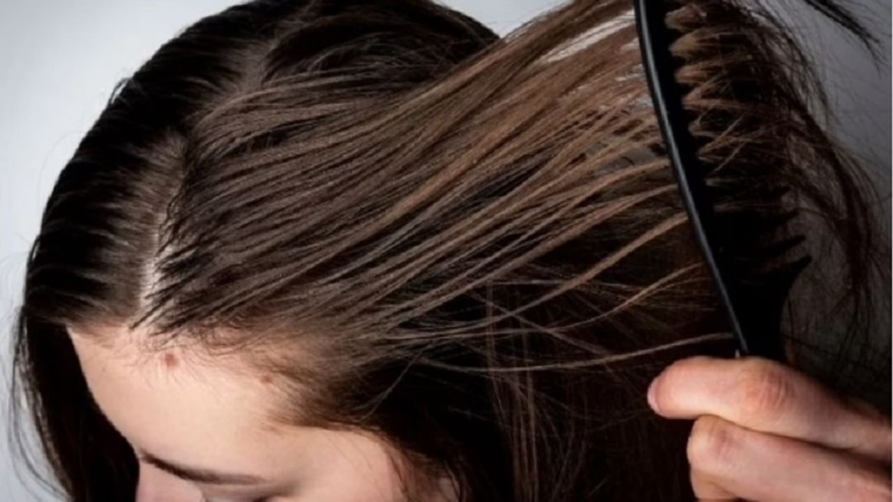 पावसाळ्यात ओलावा आणि घामामुळे केसांची काळजी घेणे कठीण होते. या हंगामात धूळ आणि सूर्यप्रकाशामुळे केस निर्जीव दिसतात. शॅम्पू लावल्यानंतर दुसऱ्याच दिवसापासून केस चिकट होतात. याचे कारण तुमच्या टाळूमध्ये आहे. जर तुमचे केस जास्त चिकट किंवा तेलकट होत असतील तर याचा अर्थ असा की तुमच्या टाळूच्या तेल ग्रंथींमधून अधिक सेबम गळत आहे. ही समस्या दूर करण्यासाठी आपण घरगुती उपाय केले पाहिजेत. 