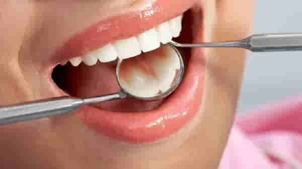 Dental Care : कॅविटीच्या समस्येने त्रस्त असाल तर हे घरगुती उपाय नक्की करून बघाच!