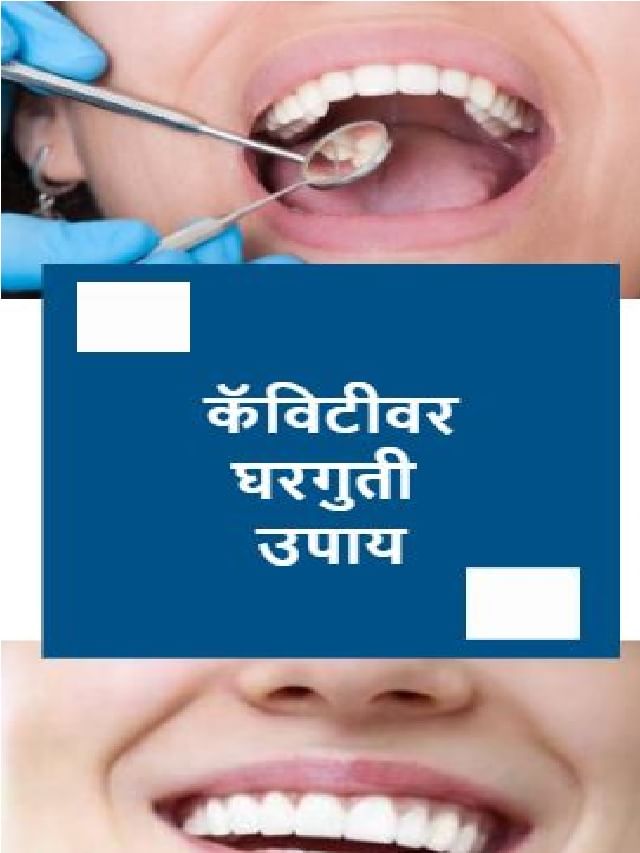 कॅविटीवर घरगुती उपाय TV9 Marathi Home Remedies For Cavity