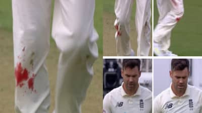 जखमी गुडघ्यातून भळाभळा रक्त वाहत असतानाही तो गोलंदाजी करत राहिला, जाँबाज अँडरसनचं नेटकऱ्यांकडून कौतुक