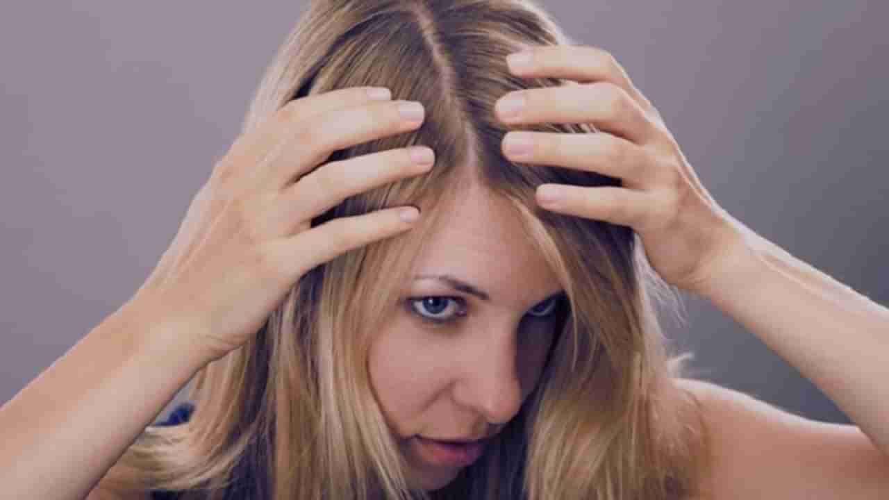 Hair Care : या नैसर्गिक घरगुती उपायांनी कोंड्याची समस्या दूर करा!