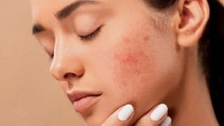 Beauty Tips : काळवंडलेले ओठ गुलाबी करण्यासाठी हे घरगुती उपाय करून पाहा!