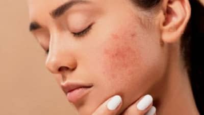Skin Care : कोरड्या आणि निर्जीव त्वचेपासून मुक्त होण्यासाठी खास 9 टिप्स!