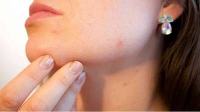 Skin Care : या नैसर्गिक उपायांनी तेलकट समस्येची समस्या दूर करा!