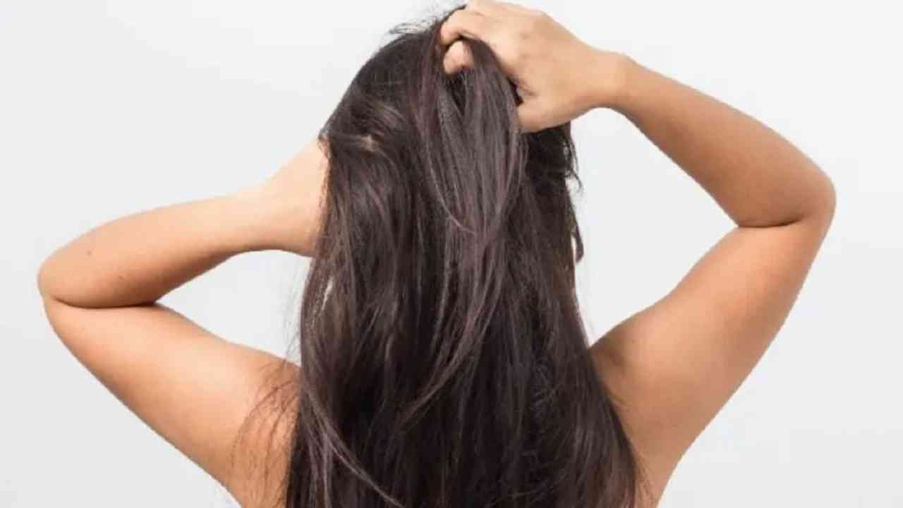 Hair Care Tips : हिवाळ्यात कोंड्याची समस्या दूर करण्यासाठी 'हे' घरगुती उपाय नक्की करा!