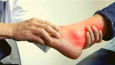 Health Care : शरीरात यूरिक अॅसिड कसे वाढते? त्याचे दुष्परिणाम नेमके कोणते, जाणून घ्या सविस्तर!