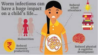 औरंगाबाद महापालिकेची उद्यापासून राष्ट्रीय जंतनाशक मोहीम, 1 ते19 वयोगटातील मुला-मुलींना जंतनाशक गोळी देणार