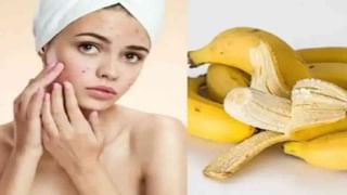 Skin Care : केसांच्या आणि त्वचेच्या आरोग्यासाठी फायदेशीर ‘नारळाचे तेल’, जाणून घ्या कसे?