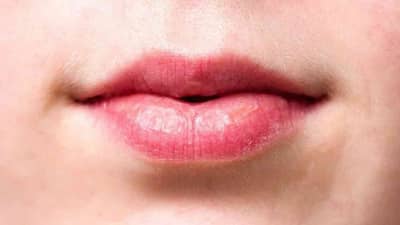 Lip Care : कोरड्या ओठांची समस्या दूर करण्यासाठी हे 4 खास उपाय!