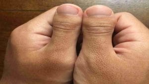 What says your thumb : अतिशय रागीट आणि अहंकारी असतात असे अंगठे असलेले लोक, विचारपूर्वक करा यांच्याशी मैत्री