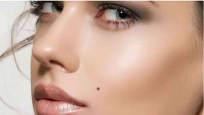 चेहऱ्यावरील नको असलेले तीळ काढण्यासाठी हे घरगुती उपाय फायदेशीर, वाचा!