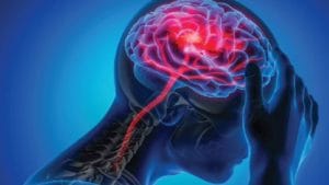 'या' चार सवयी असलेल्यांना ब्रेन स्ट्रोकचा धोका सर्वाधिक, लगेच सवयी बदला!