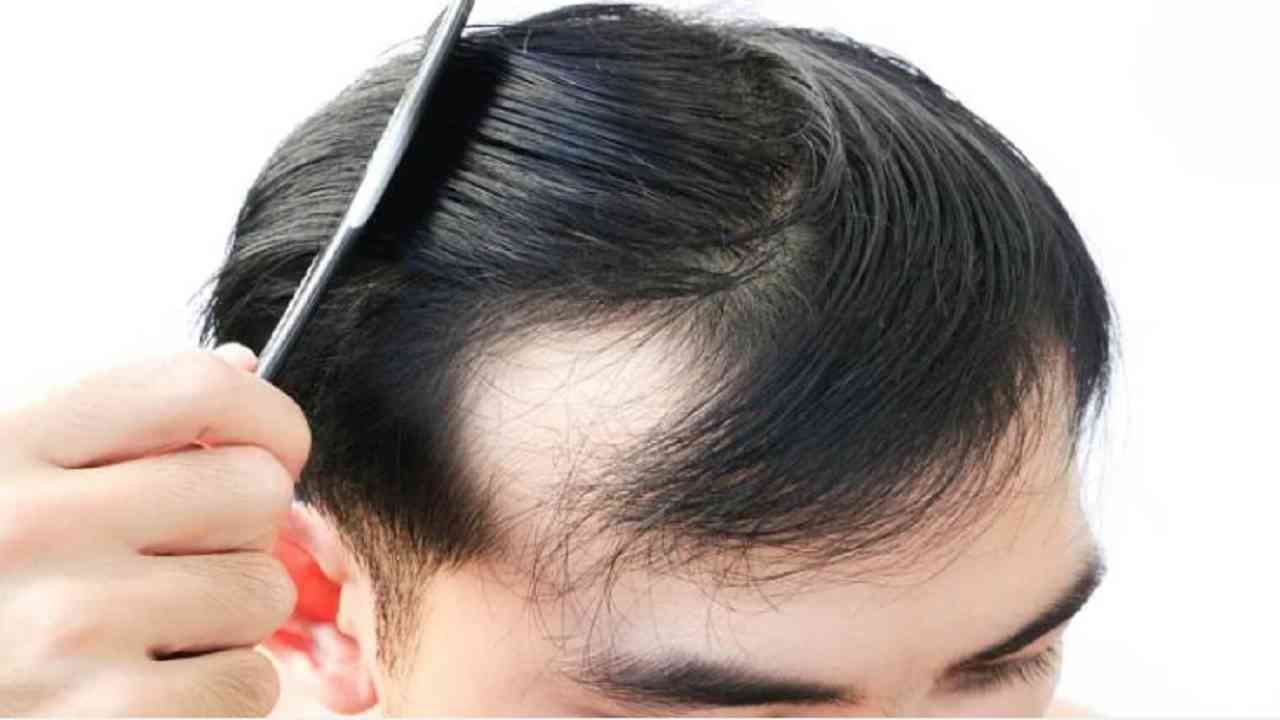 एम्सचा अभ्यास: कोरोनामधून बरे झालेल्या 28 टक्के लोकांना केस गळण्याची समस्या!