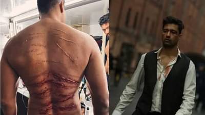 ‘Sardar Udham’ची मेहनत दाखवताना विकी कौशलने शेअर केला पाठीवरच्या वळांचा फोटो, चाहतेही झाले स्तब्ध!