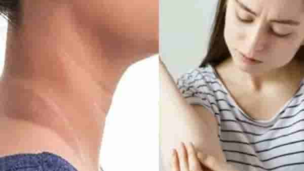 Beauty Tips : मान, कोपर आणि गुडघ्याचा काळेपणा दूर करण्यासाठी या टिप्स फाॅलो करा!