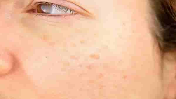 Skin Care : हिवाळ्यातही चमकदार त्वचा हवी आहे? मग हे फेसपॅक नक्की ट्राय करा!