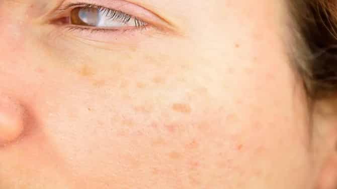 Skin Care : हिवाळ्यातही चमकदार त्वचा हवी आहे? मग हे फेसपॅक नक्की ट्राय करा!