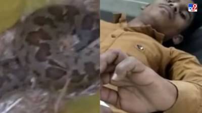 साप चावला म्हणून थेट सापालाच जिवंत पकडून डॉक्टरांसमोर आणलं, डॉक्टरांचीही भांबेरी!