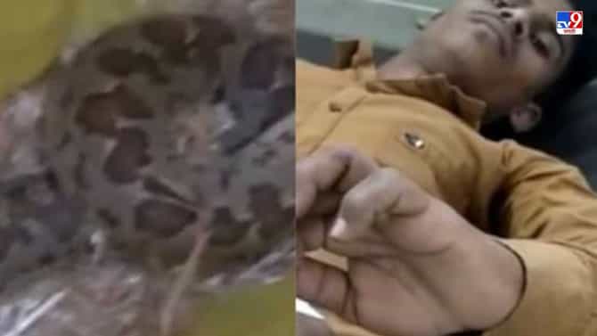 साप चावला म्हणून थेट सापालाच जिवंत पकडून डॉक्टरांसमोर आणलं, डॉक्टरांचीही भांबेरी!