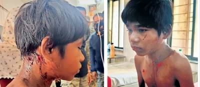 Nashik: दबा धरून बसलेल्या बिबट्याची झडप; 2 मुले रक्तबंबाळ, उपचार सुरू