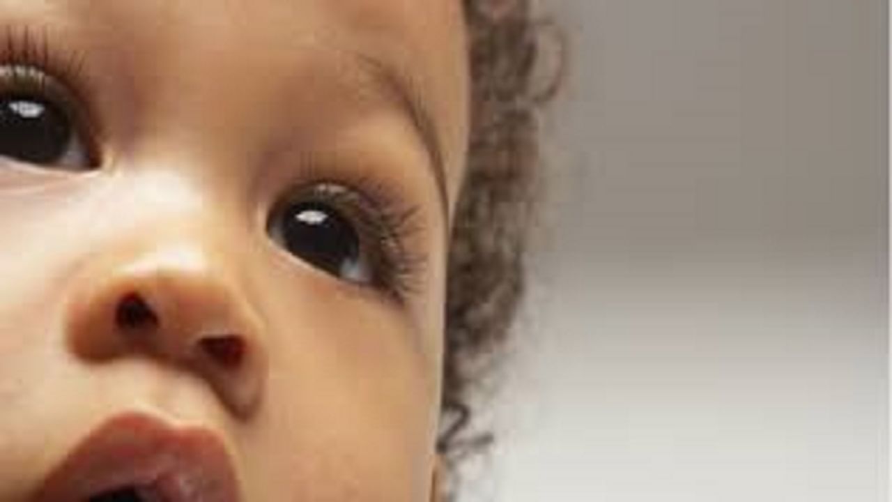 लहान मुलांचे डोळे लाल होणे, यामागची कारणं आणि उपाय
