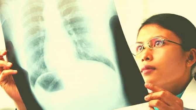 Health : फुफ्फुसाला ठेवायचं आहे निरोगी मग टाळा ‘या’ गोष्टी...
