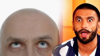 Hairloss | चंद्रावर फूल उमलणार, टकल्यावर केस उगवणार! वैज्ञानिकांनी नेमका काय शोध लावला?