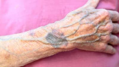 शरीरातलं रक्त लाल, मग तरिही शरीरातील नसा निळ्या का? याचं कारण फारच इंटरेस्टिंग आहे!