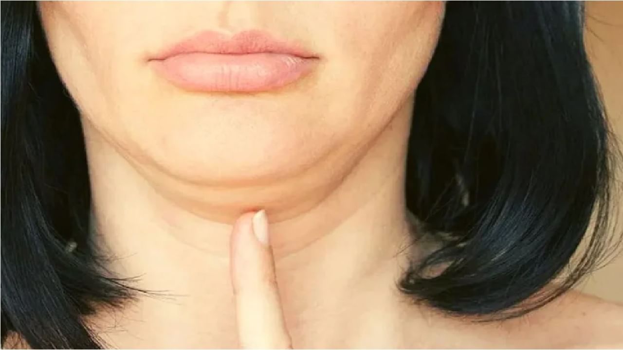 Double Chin | हनुवटीखालील अतिरिक्त चरबीने त्रस्त आहात? डबल चिनपासून मुक्तीसाठी 5 उपाय