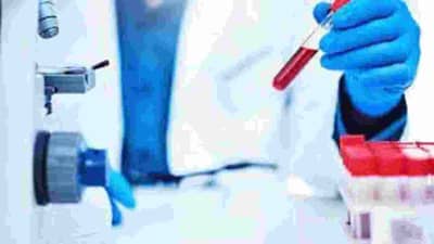 औरंगाबादमधील 15 खासगी प्रयोगशाळांना मनपाच्या नोटिसा, अँटिजन, RTPCR टेस्ट करण्यास टाळाटाळ!