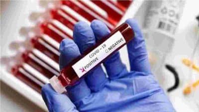 सर्दी, खोकला अन् तापही असताना कोरोना टेस्ट केली नाही? नव्या सर्वेक्षणांतून तीन महत्त्वाची कारणं उघड