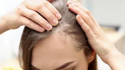 केस अकाली पांढरे होत आहेत? मग या पदार्थांचा आहारात समावेश कराच..!