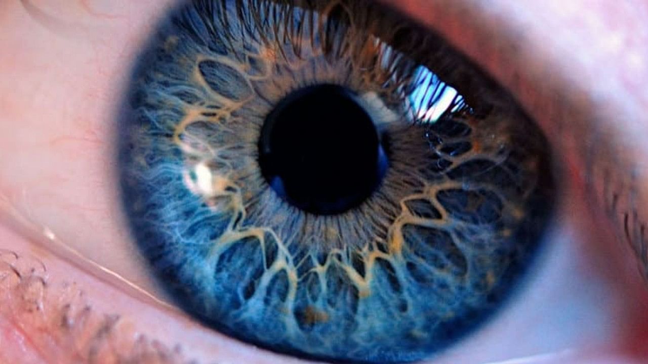बीबीसीच्या रिपोर्ट नुसार कॉन्‍सेटा यांचे डोळे टेट्राक्रोमेट आहे. सोप्या भाषेत सांगायचे झाल्यास सर्वसामान्य लोकांच्या डोळ्यांमध्ये  तीन कोन (शंकु)  असतात परंतू या व्यक्तींच्या डोळ्यामध्ये चार कोन असतात. सर्वसाधारणपणे एका कोनामध्ये दहा लाख पेक्षा अधिक रंग ओळखण्याची क्षमता असते. वैज्ञानिकांचे म्हणणे असे आहे की, 4 कोनवाल्या टेट्राक्रोमेट डोळ्यांमध्ये 10 कोटी रंग ओळखण्याची शक्ती असते.