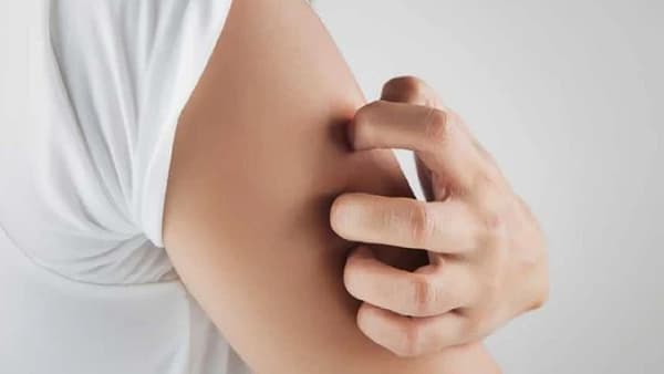 अंगाला खाज (Itching) आल्यावर प्रभावित जागी खाजवल्याने व्यक्तीला चांगले वाटते आणि एक प्रकारचा आनंद सुद्धा होतो परंतु असे का घडते? याचा कधी आपण विचार केला आहे का? या गोष्टीबद्दल संशोधन (reserch) झाले, ज्यामध्ये अनेक गोष्टींचा मागोवा घेण्यात आलेला आहे. अनेक शास्त्रज्ञांनी या संशोधनाला पाठिंबा सुद्धा दिलेले आहे. ज्यात या सर्व गोष्टीचा संबंध आपल्या मेंदूशी (Psycology) आहे असे सिद्ध केले आहे. असे नेमके काय घडते हे जाणून घेण्यासाठी शास्त्रज्ञांनी व्यक्तींच्या फंक्शनल मॅग्नेटिक रेजोनेंस (FMRI) ची टेस्टिंग केली जेणेकरून अंगावर खाजवताना आपल्या मेंदूचा योग्य तो पॅटर्न समजून घेता यावा.