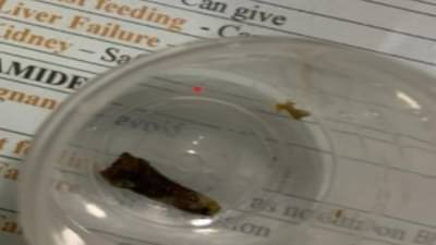 नागपुरात सात वर्षे कॅन्सरची भीती घेऊन जगली महिला; शस्त्रक्रिया केल्यावर निघाले भलतेय काही!