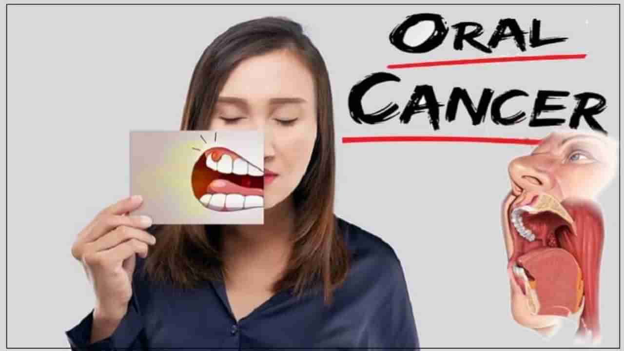 Oral Cancer : या गोष्टींची काळजी घेतल्यास कधीच होणार नाही तोंडाचा कर्करोग