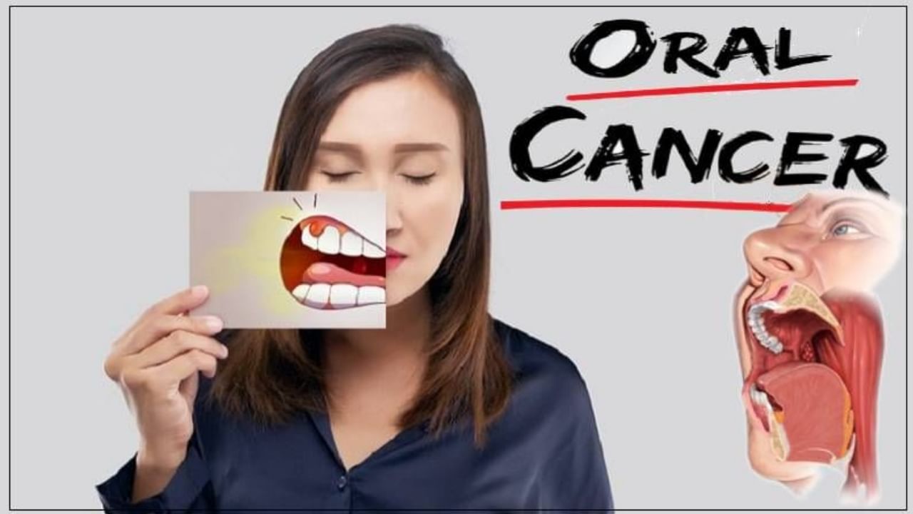 Oral Cancer : 'या' गोष्टींची काळजी घेतल्यास कधीच होणार नाही तोंडाचा कर्करोग