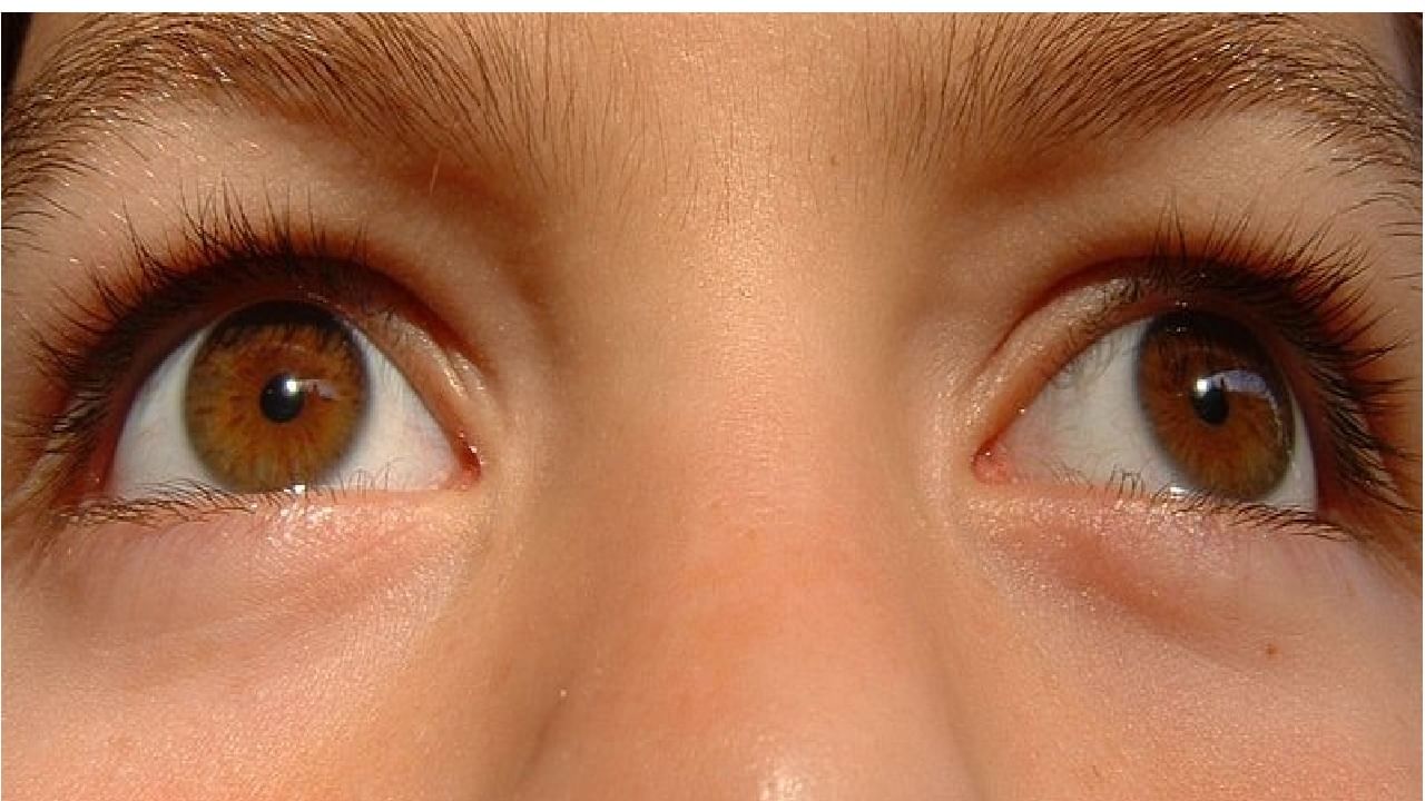 Symptoms of High Cholesterol : कोलेस्ट्रॉल वाढल्याच्या खुणा डोळ्यांवरही दिसतात? जाणून घ्या लक्षणं
