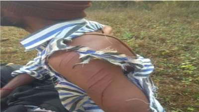 अस्वलाच्या हल्ल्यात ग्रामपंचायत कर्मचारी जखमी; कोल्हापूर जिल्ह्यातील घटना; चंदगड तालुक्यात हत्ती, गवे, बिबट्यानंतर आता पुन्हा अस्वलांचा वावर