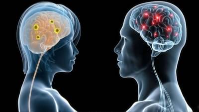 Multiple Sclerosis : मल्‍टीपल स्क्लेरोसिस या गंभीर आजाराचे प्रकार जाणून घ्या