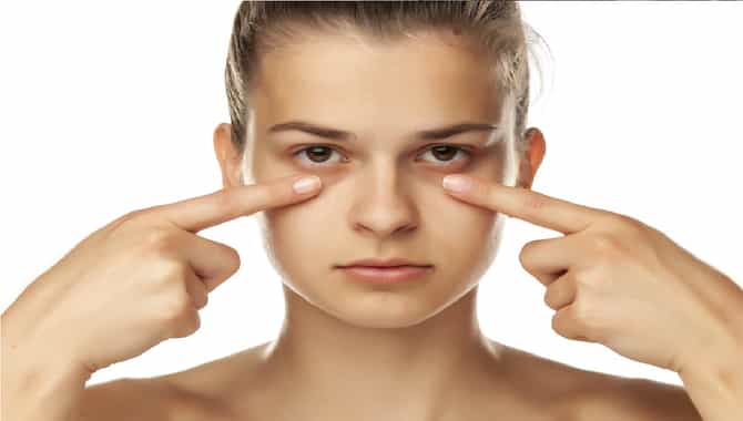 तुमच्या डोळ्याच्या खालीही डार्क सर्कल आहेत?, हे घरगुती उपाय करा आणि डार्क सर्कल दूर पळवा!