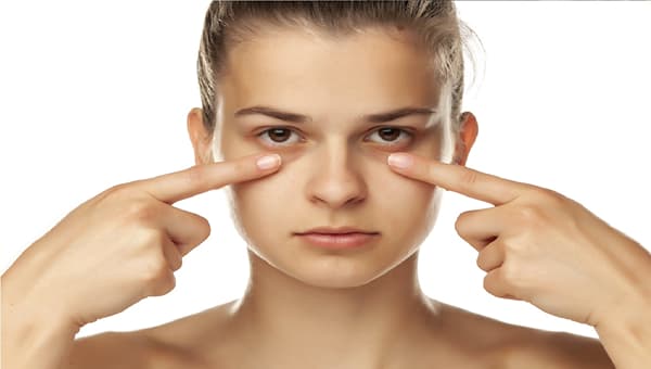 तुमच्या डोळ्याच्या खालीही डार्क सर्कल आहेत?, हे घरगुती उपाय करा आणि डार्क सर्कल दूर पळवा!