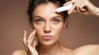 Skin Care : चेहऱ्यावरील काळ्या डागांची समस्या दूर करण्यासाठी ‘या’ पदार्थांचे नियमित सेवन करा!