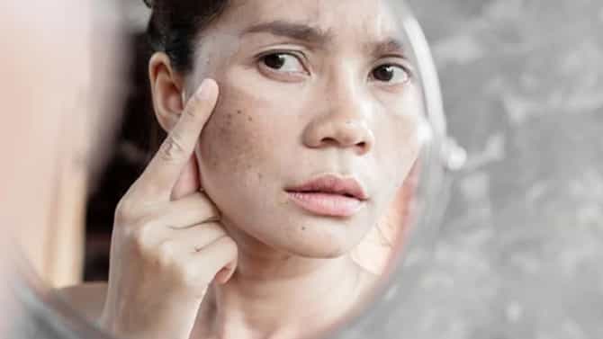 Skin Care : चेहऱ्यावरील काळ्या डागांची समस्या दूर करण्यासाठी या पदार्थांचे नियमित सेवन करा!