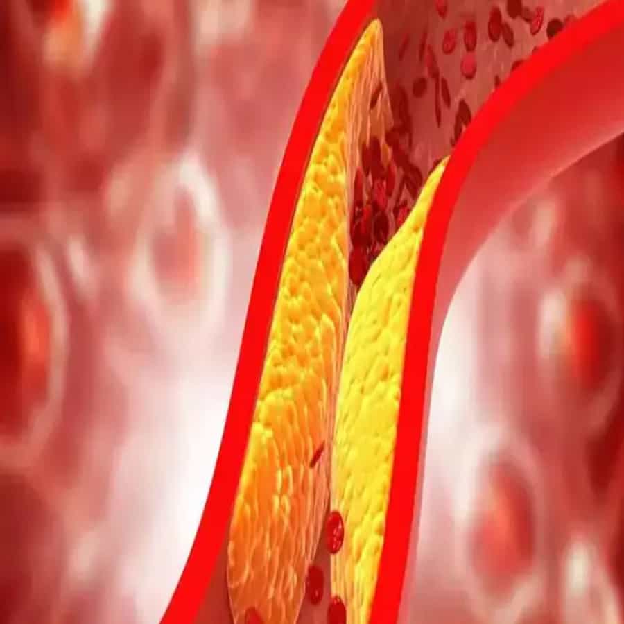 कोलेस्ट्रॉल- असे म्हटले जाते की पेरूमध्ये मोठ्या प्रमाणात फायबर आढळते. फायबर खराब कोलेस्ट्रॉल कमी करण्यास मदत करते. विशेष म्हणजे पेरू खराब कोलेस्ट्रॉल कमी करून चांगले कोलेस्ट्रॉल वाढवते.