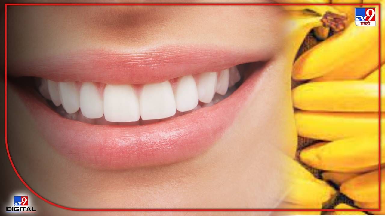 Teeth | मजबूत अन्‌ चमकदार दातांसाठी फळांचा वापर ठरेल फायदेशीर! जाणून घ्या 5 फळांबद्दल